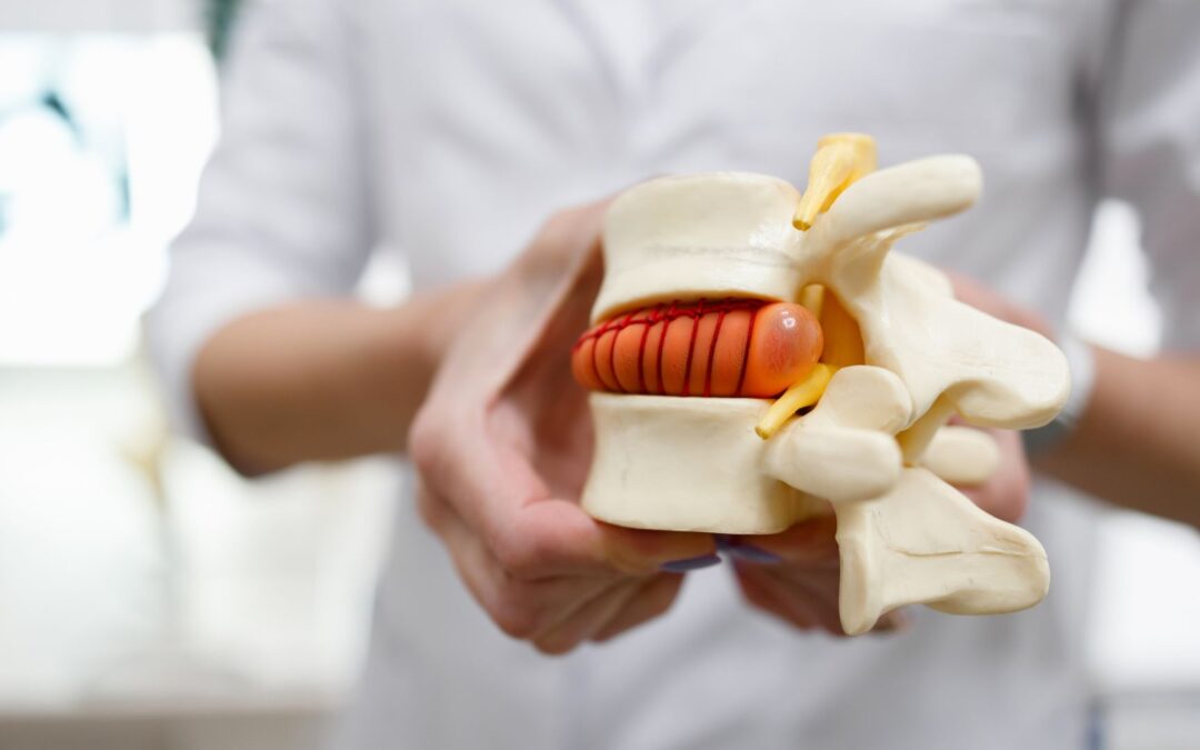Herniated Disc: Signs, Care Options, and Next Steps
