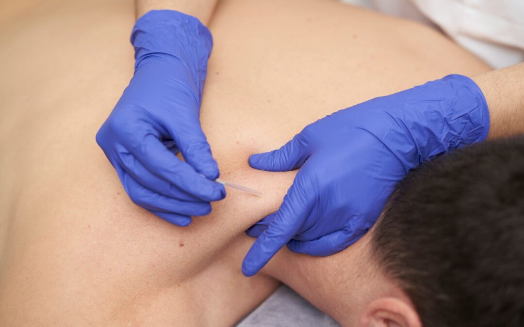 Upper Trap Tightness: Fast Relief Without Harsh Meds