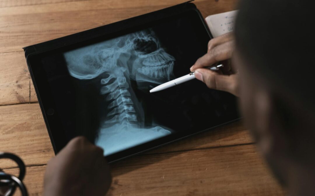 Signs of Cervical Radiculopathy and How Chiropractic Care Can Help – symptoms, causes, and conservative treatment options