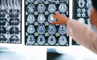 What imaging really shows (X-ray/MRI) and when it’s useful