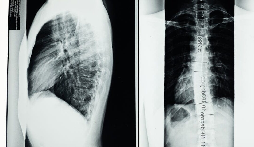 TMJ Disorders and Neck Alignment – connection between jaw and cervical spine