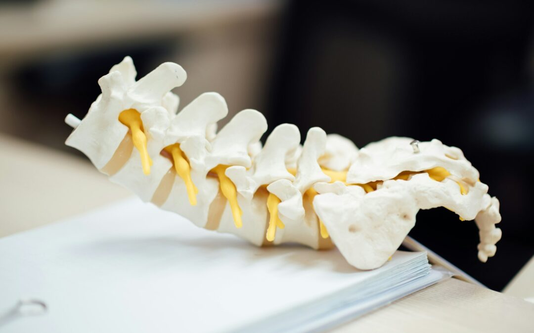 Spondylolisthesis vs. Spondylosis – what’s the difference?
